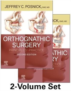 Orthognathic Surgery - 2 Volume Set : Principles and Practice, 2e