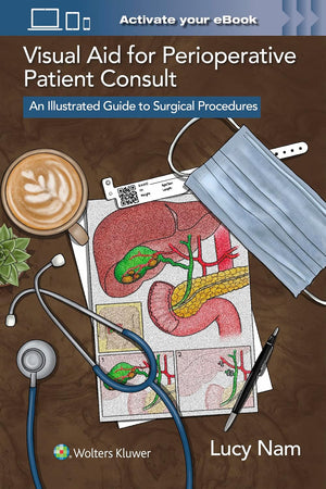 Visual Aid for Perioperative Patient Consult: An Illustrated Guide to Surgical Procedures