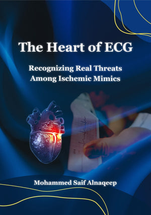 The Heart of ECG : Recognizing Real Threats Among Ischemic Mimics