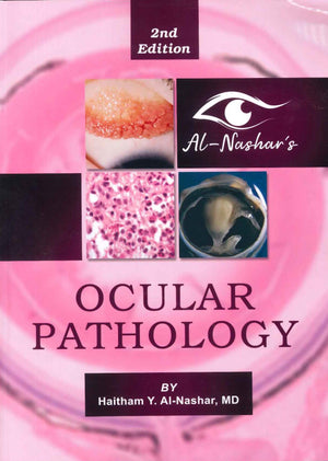 Al-Nashar's Ocular Pathology, 2e