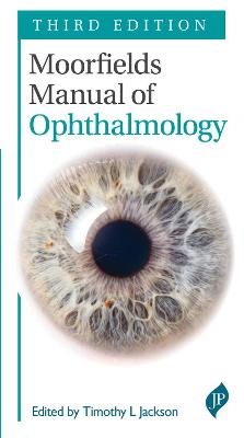 Moorfields Manual of Ophthalmology, 3e