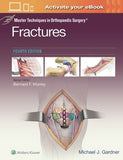 Master Techniques in Orthopaedic Surgery: Fractures, 4e