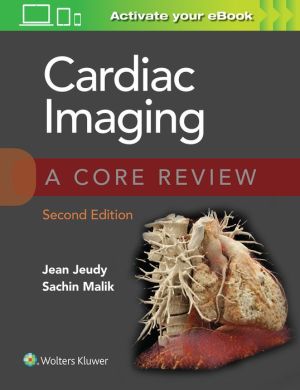 Cardiac Imaging: A Core Review, 2e