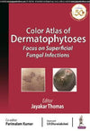 Color Atlas of Dermatophytoses: Focus on Superficial Fungal Infections