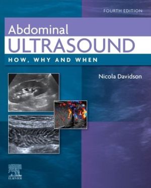 Abdominal Ultrasound : How, Why and When, 4e