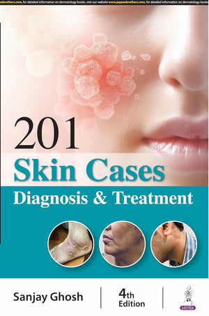 201 Skin Cases Diagnosis & Treatment, 4e