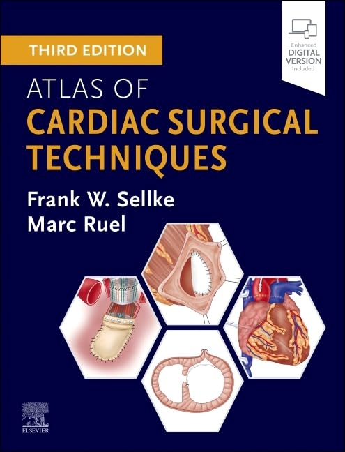 Cardiac Surgery – Khaleej Al-Kitab (Book Bay)