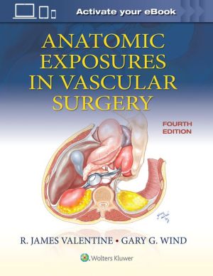 Anatomic Exposures in Vascular Surgery, 4e