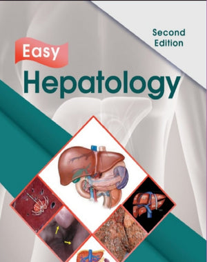 Easy Hepatology , 2e