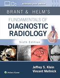 Brant & Helm's Fundamentals of Diagnostic Radiology: Print + eBook with Multimedia, 6e