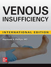 Venous Insufficiency (IE)