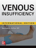 Venous Insufficiency (IE)