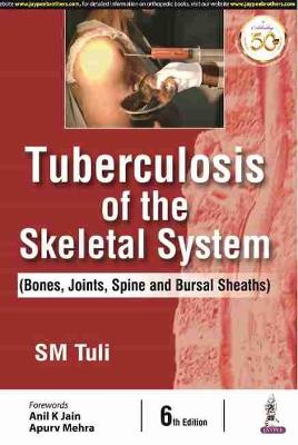 Tuberculosis of the Skeletal System (Bones, Joints, Spine and Bursal Sheaths), 6e