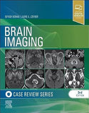Brain Imaging: Case Review Series, 3e