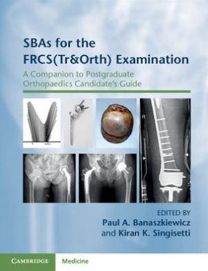 SBAs for the FRCS(Tr&Orth) Examination : A Companion to Postgraduate Orthopaedics Candidate's Guide**