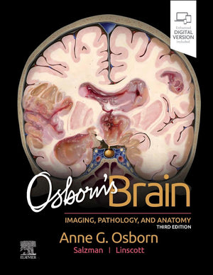 Osborn's Brain, 3e