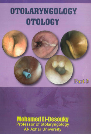 Otolaryngology Otology Part 3