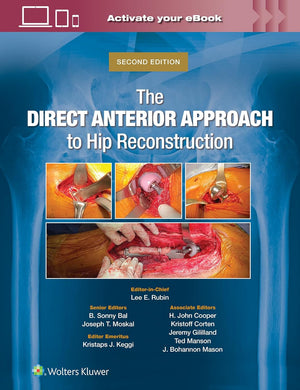 The Direct Anterior Approach to Hip Reconstruction, 2e