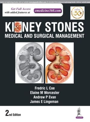 Kidney Stones: Medical and Surgical Management, 2e