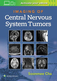 Imaging of CNS Tumors