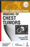 Clinico Radiological Series Imaging of Chest Tumors