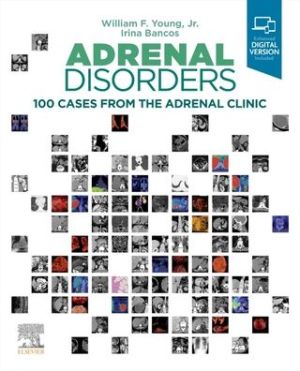 Adrenal Disorders : 100 Cases from the Adrenal Clinic