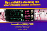 Tips and Tricks of Reading ECG : With arrhythmias and Conduction Abnormalities