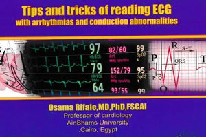 Tips and Tricks of Reading ECG : With arrhythmias and Conduction Abnormalities