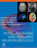 Fetal, Neonatal and Pediatric Neuroradiology