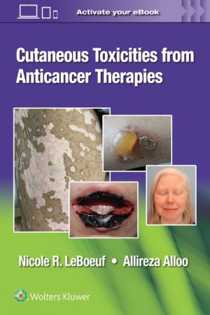 Cutaneous Reactions to Anti-Cancer Therapies