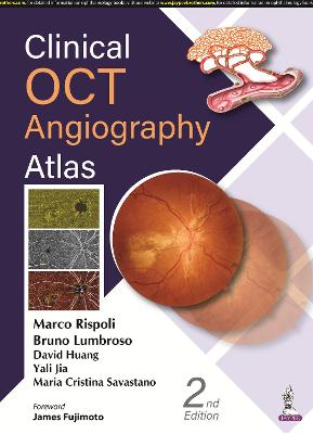 Clinical OCT Angiography Atlas, 2e