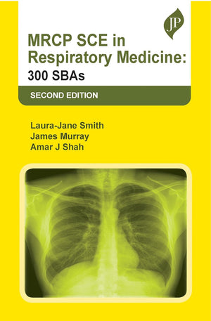 MRCP SCE in Respiratory Medicine: 300 SBAs, 2e