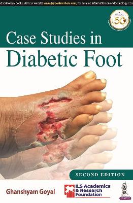 Case Studies in Diabetic Foot, 2e