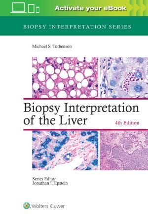 Biopsy Interpretation of the Liver, 4e