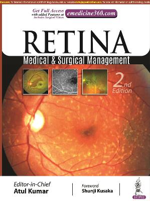 Retina: Medical & Surgical Management, 2e