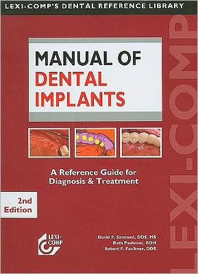 Manual of Dental Implants 2e **