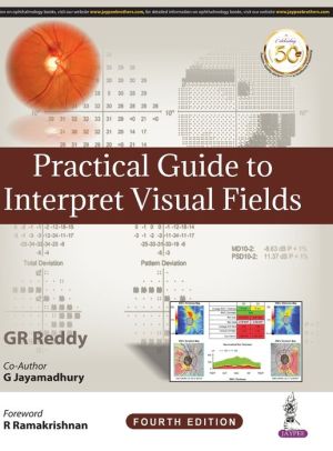 Practical Guide to Interpret Visual Fields, 4e