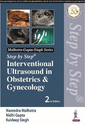 Step by Step Interventional Ultrasound in Obstetrics & Gynecology, 2e