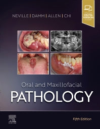 Oral and Maxillofacial Pathology, 5e