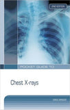 Pocket Guide to Chest X-rays, 2e**