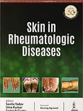 Skin in Rheumatologic Diseases