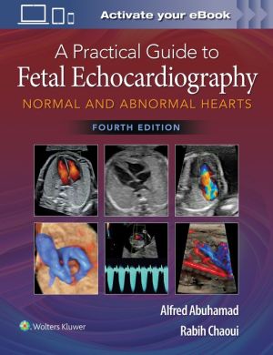 A Practical Guide to Fetal Echocardiography: Normal and Abnormal Hearts, 4e