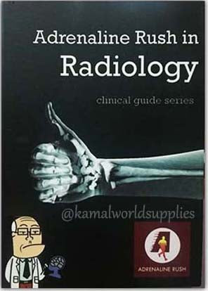 Adrenaline Rush in Radiology