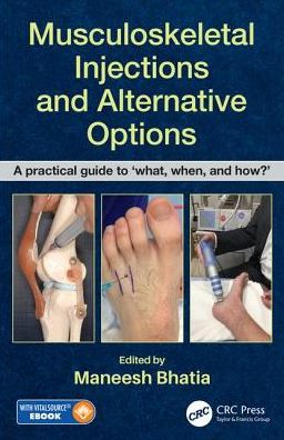 Musculoskeletal Injections and Alternative Options: A practical guide to 'what, when and how?'