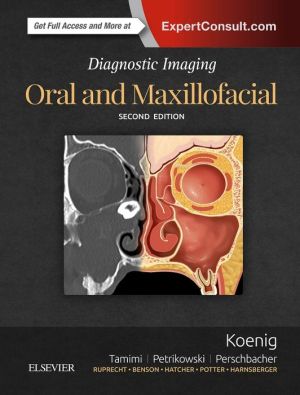 Diagnostic Imaging: Oral and Maxillofacial , 2nd Edition