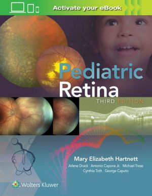 Pediatric Retina, 3e