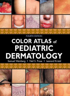 Color Atlas Pediatric Dermatology, 4e