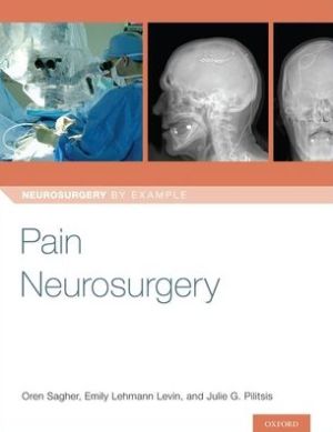 Pain Neurosurgery