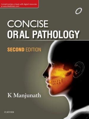 Concise Oral Pathology, 2e