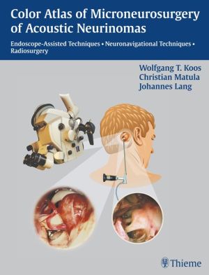 Color Atlas of Microsurgery of Acoustic Neurinomas : Endoscope-Assisted Techniques - Neuronavigational Techniques - Radiosurgery** | Book Bay KSA